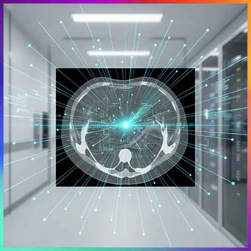 Alibabaâ€™s PANDA AI detects pancreatic cancer early using CT scans